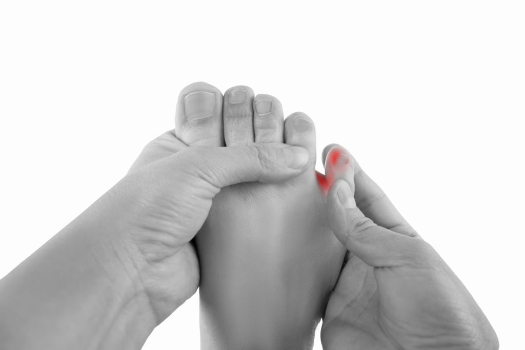 how-to-treat-a-bunion-on-your-pinky-toe-the-bunion-cure