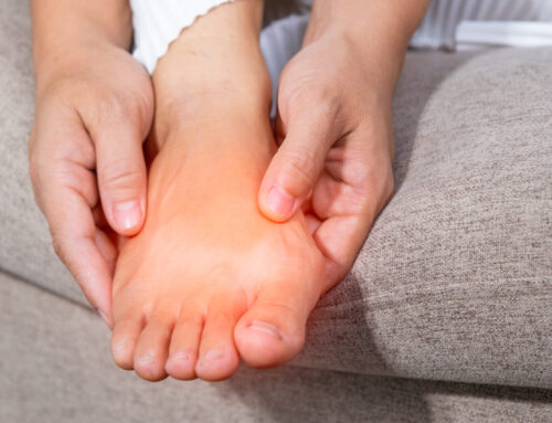 When Should You Get Bunion Surgery? 5 Signs Now Is the Time