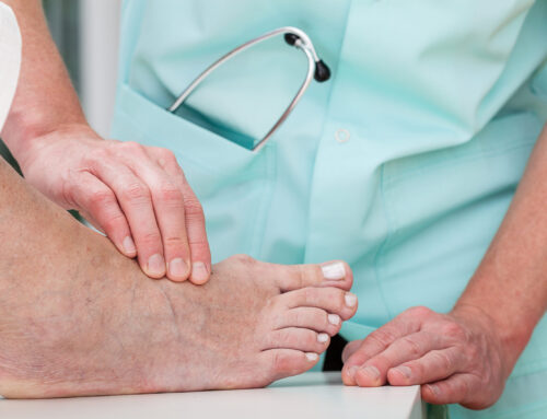 Is Bunion Surgery Covered By Insurance?