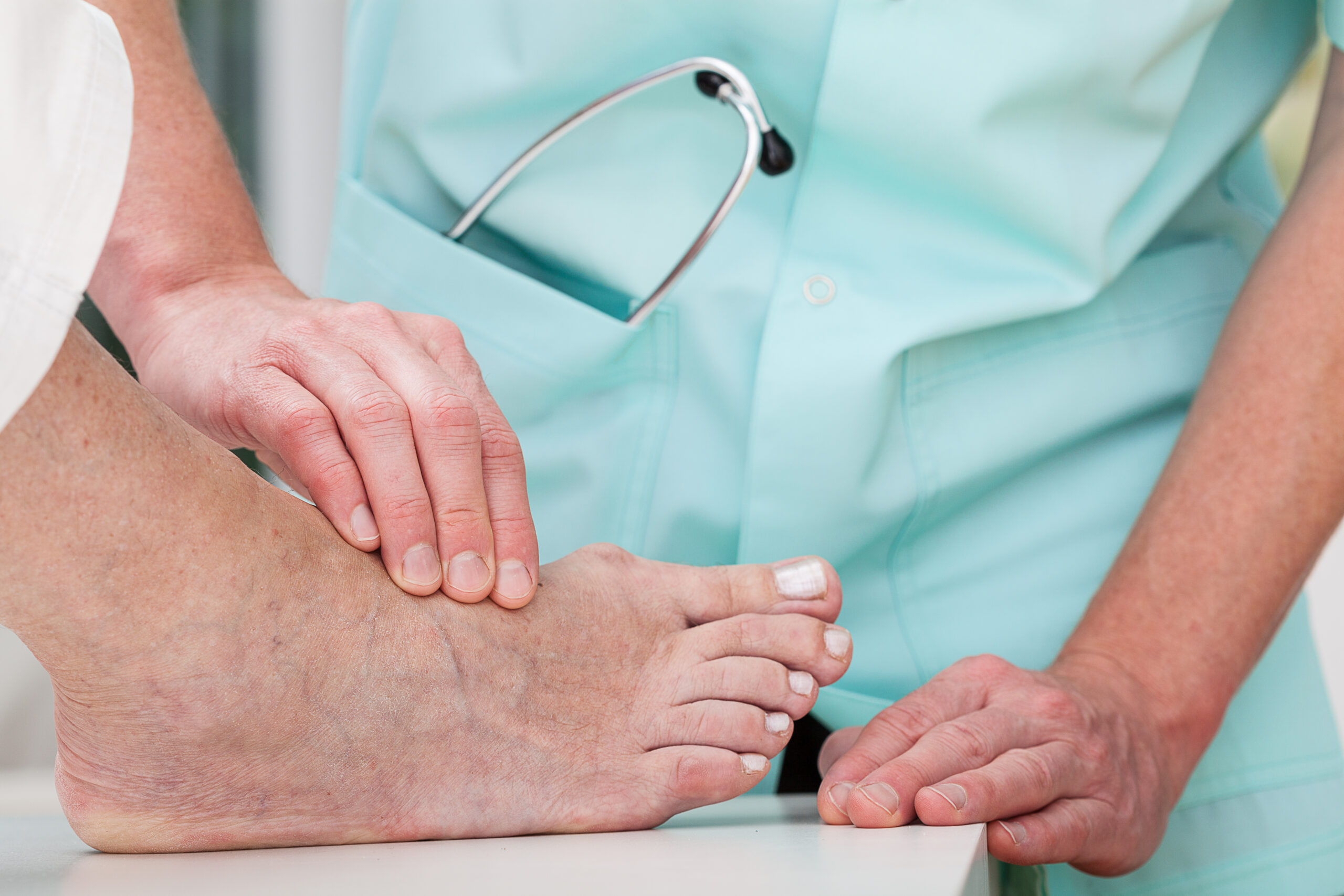 is bunion surgery covered by insurance