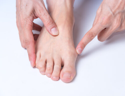 Bunion vs Callus: How to Tell the Difference