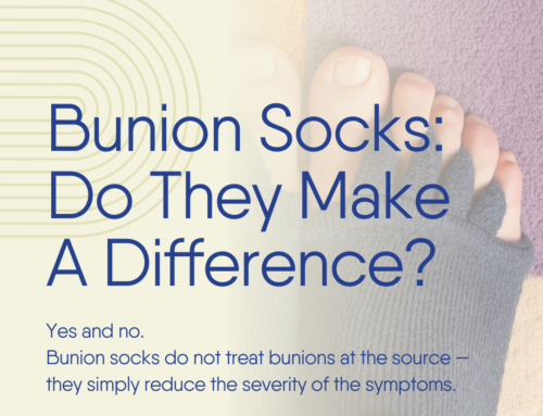 Bunion Socks: Do They Make A Difference?