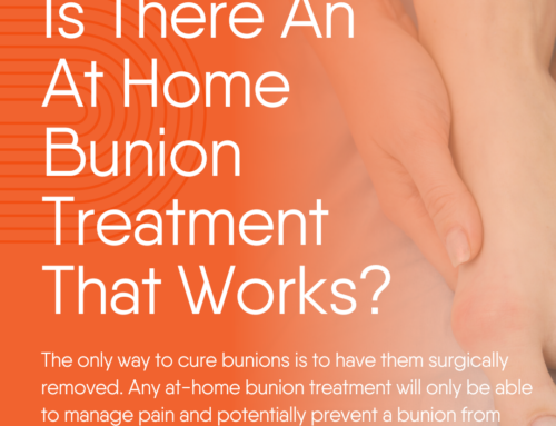 Is There An At Home Bunion Treatment That Works?