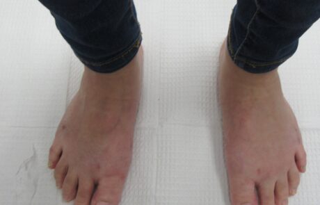 feet