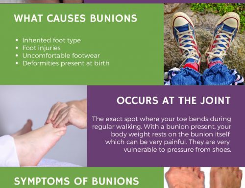 What You Need To Know About Bunions Infographic