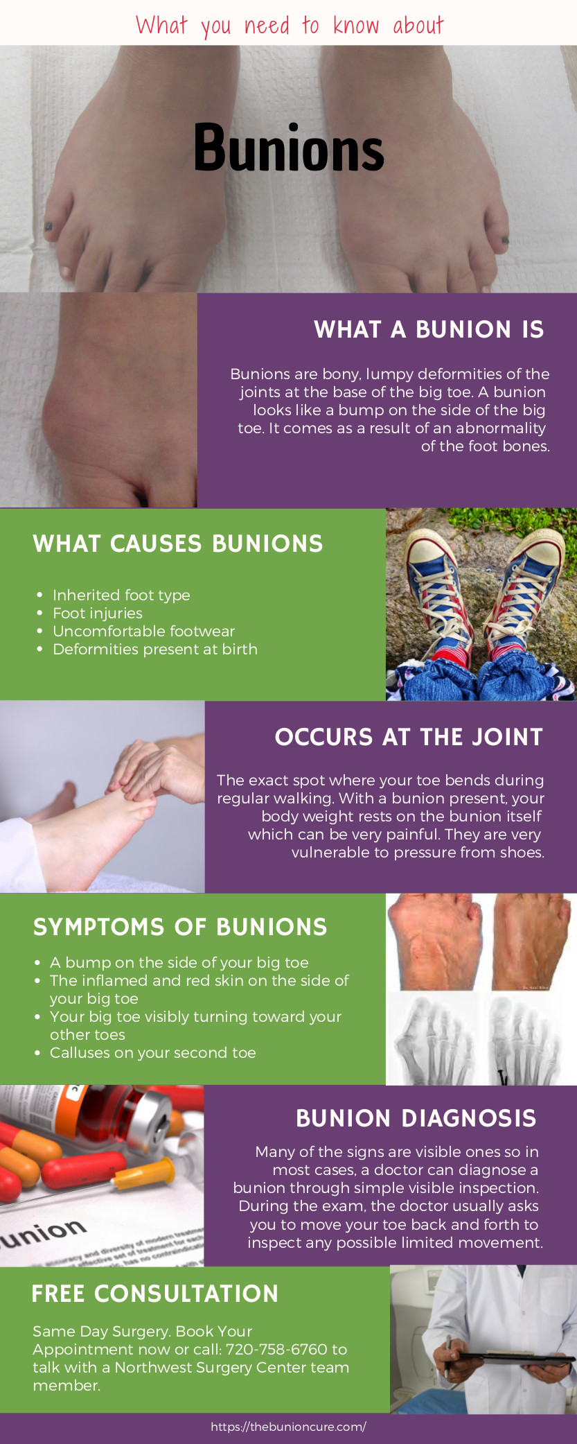 What You Need To Know About Bunions Infographic