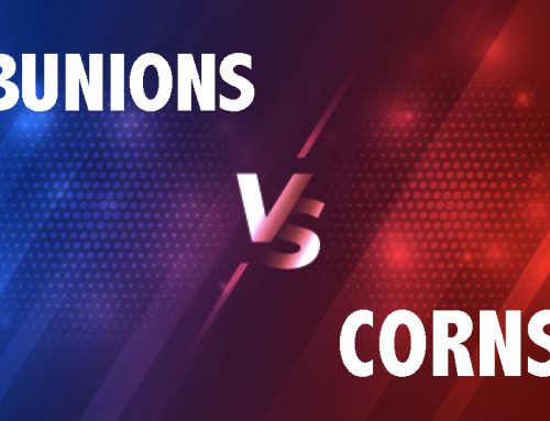 Bunions vs Corns: What’s the Difference?