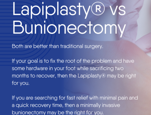 Lapiplasty® vs Bunionectomy: What Are The Main Differences?