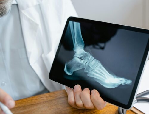 What Is a Podiatrist and When Should You See One?